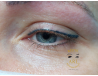 Micropigmentación Eye-liner inferior